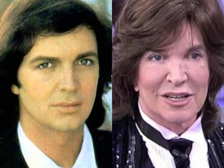 camilo-sesto-muere-a-los-72-años1
